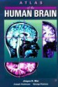 Atlas of the Human Brain - Jürgen K. Mai, George Paxinos, Joseph K. Assheuer