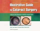 Illustrative Guide to Cataract Surgery: A Step-by-Step Approach to Refining Surgical Skills - Amar Agarwal