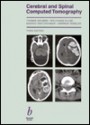 Cerebral And Spinal Computed Tomography - Thomas Grumme