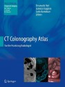 CT Colonography Atlas: For the Practicing Radiologist (Medical Radiology / Diagnostic Imaging) - Emanuele Neri, Lorenzo Faggioni, Carlo Bartolozzi