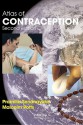 Atlas of Contraception, Second Edition (ENCYCLOPEDIA OF VISUAL MEDICINE SERIES) - Pramilla Senanayake, Malcolm Potts