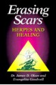 Erasing Scars: Herpes and Healing - James D. Okum