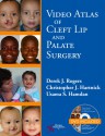 Video Atlas of Cleft Lip and Palate Surgery - Rogers