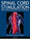 Spinal Cord Stimulation Implantation: Percutaneous Implantation Techniques - Paul Kreis, Scott Fishman