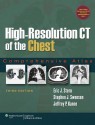 High-Resolution CT of the Chest: Comprehensive Atlas - Eric J. Stern