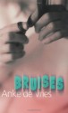 Bruises - Anke de Vries, Stacey Knecht