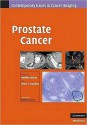 Prostate Cancer - Peter T. Scardino