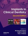 Implants in Clinical Dentistry - Richard M Palmer