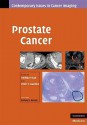 Prostate Cancer - Hedvig Hricak