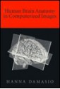 Human Brain Anatomy in Computerized Images - Hanna Damásio