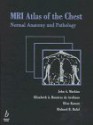MRI Atlas of the Chest - John A. Markisz