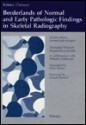 Borderlands of Normal and Early Pathologic Findings in Skeletal Radiography - Hermann Schmidt