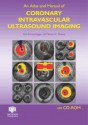 An Atlas and Manual of Coronary Intravascular Ultrasound Imaging - Paul Schoenhagen, Steven E. Nissen
