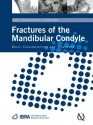 Fractures of the Mandibular Condyle: Basic Considerations and Treatment - Johannes Kleinheinz, Christopher Meyer, Christophe Meyer