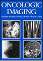 Oncologic Imaging: A Clinical Perspective - Claudia G. Berman, Robert A. Clark