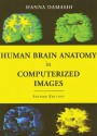 Human Brain Anatomy in Computerized Images - Hanna Damásio