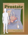 Atlas of the Prostate - Peter T. Scardino, Kevin Slawin