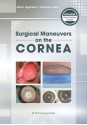 Surgical Maneuvers on the Cornea - Amar Agarwal, Thomas John