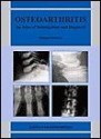 Oesteoarthritis: An Atlas of Investigation and Diagnosis - M. Doherty, A. Jones