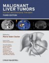 Malignant Liver Tumors: Current And Emerging Therapies - Pierre-Alain Clavien, Stefan Breitenstein, Ravi S. Chari, Michael A. Morse