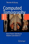 Computed Tomography: From Photon Statistics to Modern Cone-Beam CT - Thorsten M. Buzug