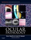 Ocular Pathology: Expert Consult - Online and Print - Myron Yanoff, Joseph W Sassani