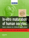 In Vitro Maturation of Human Oocytes - Seang Lin Tan