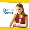 Broken Bones - Elaine Landau