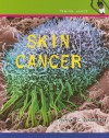 Skin Cancer - Marjorie L. Buckmaster