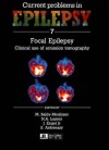 Focal Epilepsy: Proceedings Of The International Symposium On Focal Epilepsy: Clinical Use Of Emission Tomography, Held In Paris, May 1989 - M. Baldy-Moulinier, Neils A. Lassen, Jerome Engel Jr., S. Ashkienazy