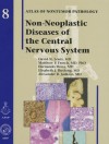 Non-Neoplastic Diseases of the Central Nervous System - David N. Louis, Matthew P. Frosch, Hernando Mena, Elisabeth J. Rushing