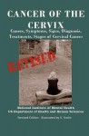 Cancer of the Cervix: Causes, Symptoms, Signs, Diagnosis, Treatments, Stages of Cervical Cancer- Revised Edition - Illustrated by S. Smith - Department of Health and Human Services, National Institutes of Health, National Cancer Institute