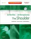 Arthritis and Arthroplasty: the Shoulder - David M. Dines, Gerald R. Williams