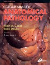 Colour Atlas of Anatomical Pathology - Robin A. Cooke, Brian Stewart