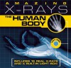 Amazing X-rays: The Human Body - Paul Beck