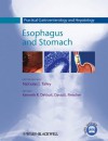 Practical Gastroenterology and Hepatology: Esophagus and Stomach - Nicholas J. Talley, Kenneth R. DeVault, David E. Fleischer