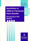 Quantitation Of Mrna By Polymerase Chain Reaction: Nonradioactive Pcr Methods - Thomas Köhler, th Kohler, T. Kohler