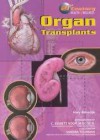 Organ Transplants - Mary Kittredge