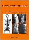 Cancer and the Skeleton - ROBERT RUBENS, Gregory R. Mundy