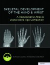 Skeletal Development of the Hand and Wrist: A Radiographic Atlas and Digital Bone Age Companion - Cree M. Gaskin, S. Lowell Kahn, J. Christoper Bertozzi, Paul M. Bunch