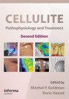 Cellulite: Pathophysiology And Treatment (Basic And Clinical Dermatology) - Mitchel P. Goldman, Doris Hexsel