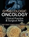 Gynecologic Oncology: Clinical Practice and Surgical Atlas - Karlan, Beth Karlan, Robert Bristow