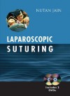 Laparoscopic Suturing - Nutan Jain