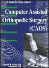 Computer Assisted Orthopedic Surgery (Caos) - R. Ganz