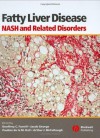 Fatty Liver Disease: NASH and Related Disorders - Geoffrey C. Farrell, Jacob George, Pauline de la M. Hall, Arthur J. McCullough