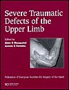 Severe Traumatic Defects Of The Upper Limb - Alain C. Masquelet