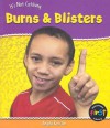 Burns & Blisters - Angela Royston