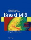 Breast MRI: Diagnosis and Intervention - Elizabeth Morris