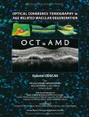 Optical Coherence Tomography in Age-Related Macular Degeneration - Gabriel Coscas