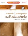 Arthritis and Arthroplasty: The Foot and Ankle: Expert Consult - Online, Print and DVD - Christian Coetzee, Shepard R. Hurwitz